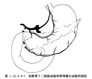 胰胃论